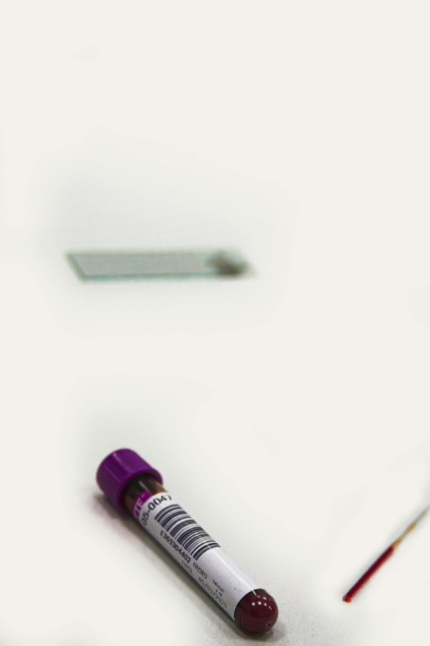 Explication visuelle du prélèvement SGC